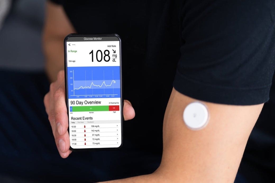 Continuous Glucose Monitoring: What You Need to Know About This Game-Changing Technology