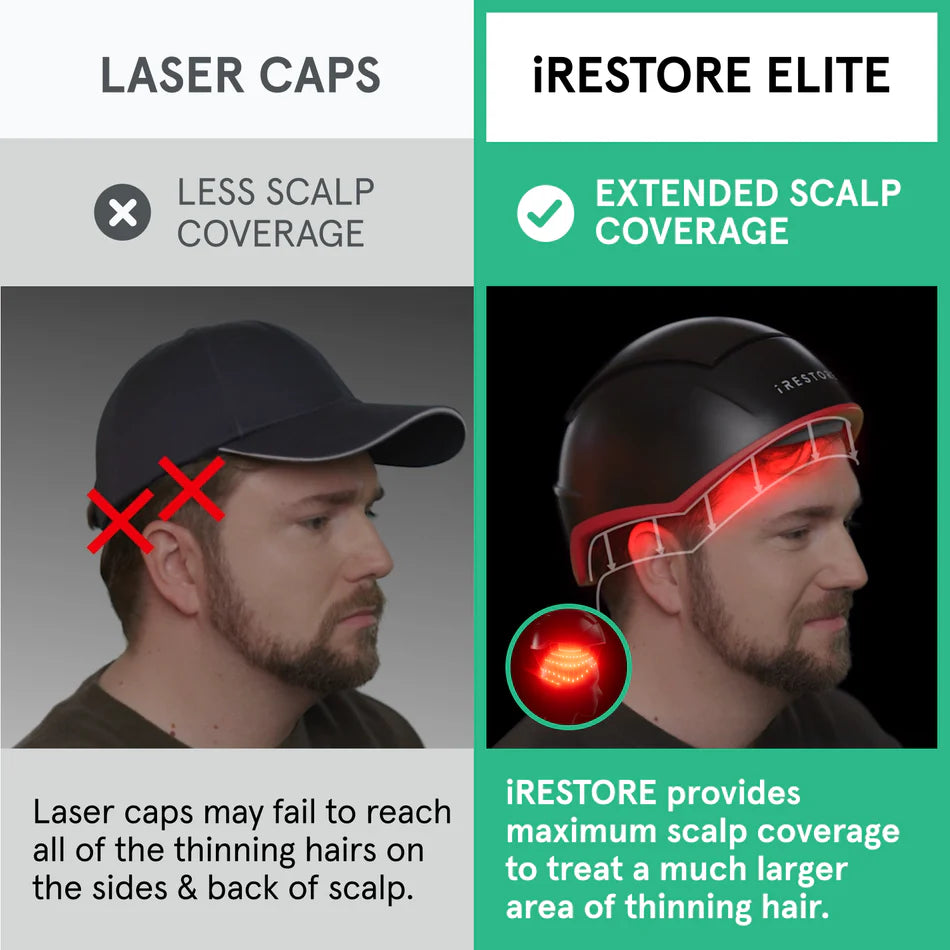 iRESTORE Elite Laser Hair Growth System - HSA/FSA Eligible