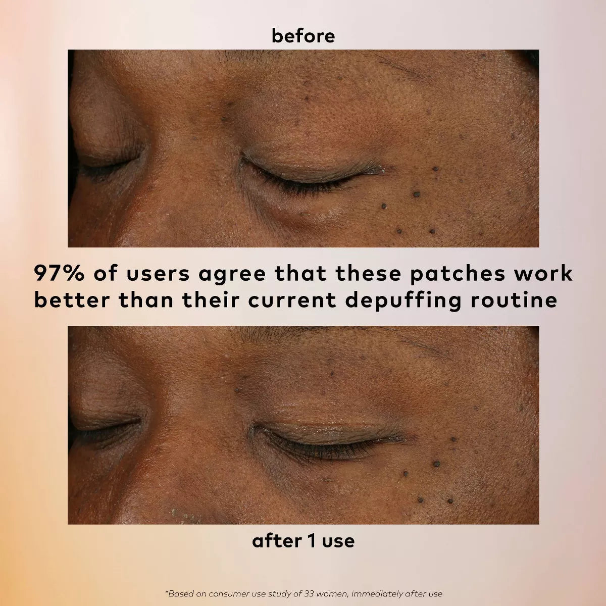 The Good Patch De-Puff Hydrogel Undereye Patch Set