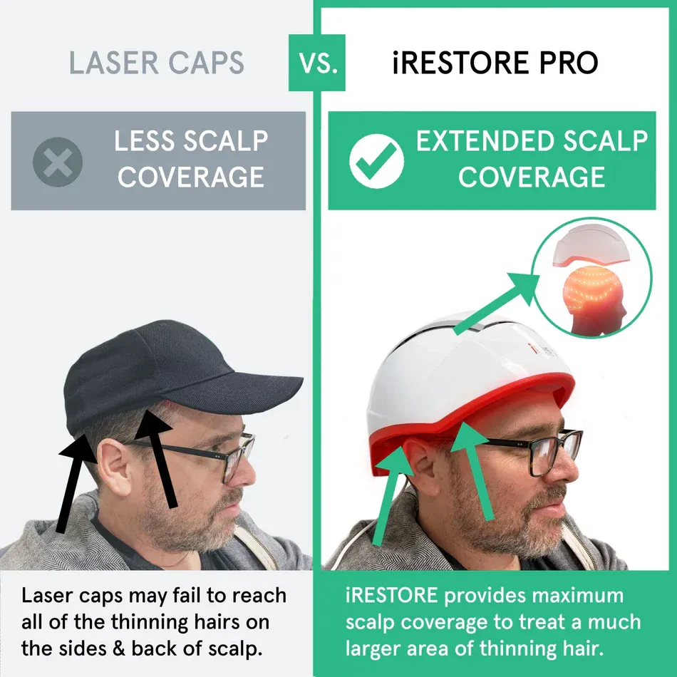 iRESTORE Professional Laser Hair Growth System - HSA/FSA Eligible