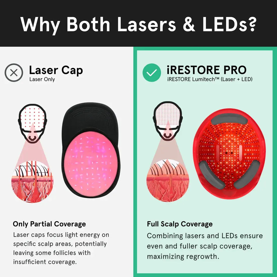 iRESTORE Professional Laser Hair Growth System - HSA/FSA Eligible