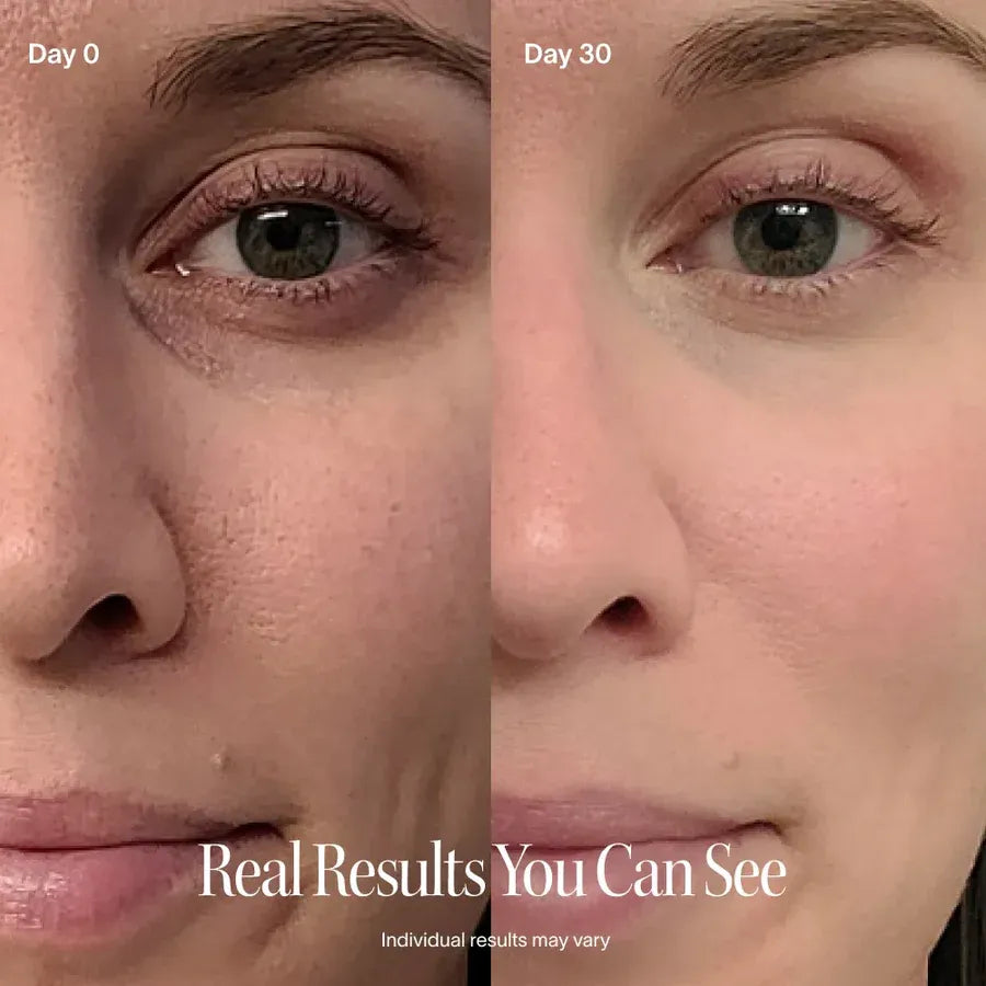Solawave Radiant Renewal® Eye Recovery Pro