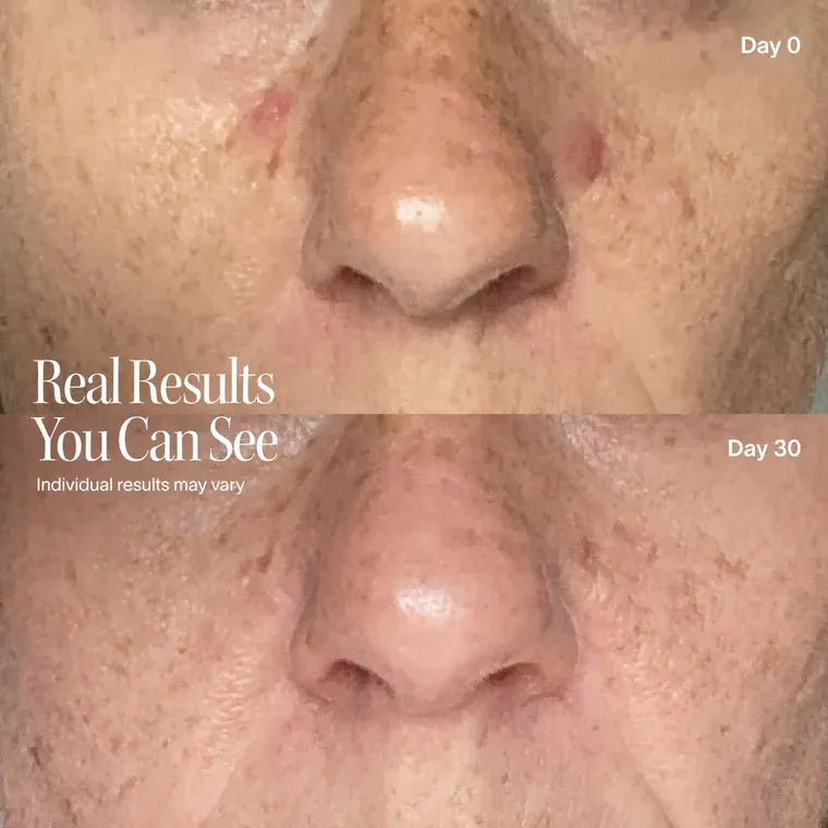 Solawave Wrinkle Retreat Pro LED Face Mask