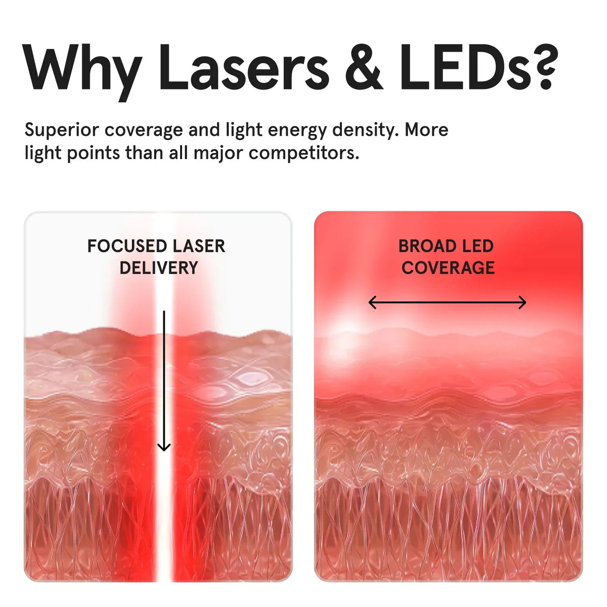 iRESTORE Laser Face Mask Pro LED Red Light Therapy