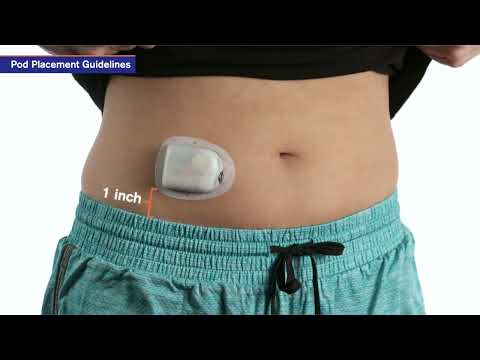 Omnipod® DASH® Pods for the Omnipod® DASH® System (5-Pack)